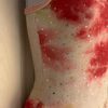 GK ICE FIGURE SKATE ADULT SMALL PINK SERPENTINE TIE-DYE STRETCH TANK DRESS AS NW - Image 4